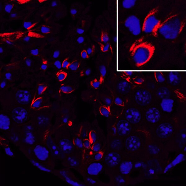 Immunofluorescence image of GM130-deficient mouse testes labeled with DSHB antibody AA12.1 against beta-tubulin (red). PMID: 28055014, Fig. S6D.